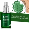 Xịt khử mùi hôi nách ngăn ngừa mồ hôi dưới cánh tay LUOKOU 30ml Serum khử mùi mồ hôi cơ thể cho nam nữ