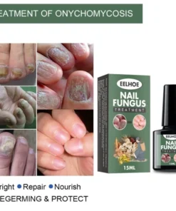 Serum nấm móng tay chân EELHOE 15ml dưỡng cứng hết sạch nấm bọng móng hư khoé nước 11 kemnam3 1