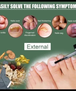 Serum nấm móng tay chân EELHOE 15ml dưỡng cứng hết sạch nấm bọng móng hư khoé nước 12 kemnam4 1