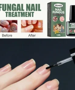 Serum nấm móng tay chân EELHOE 15ml dưỡng cứng hết sạch nấm bọng móng hư khoé nước 13 kemnam5