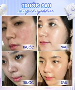 Mặt nạ thạch Collagen Seyoul Hàn Quốc, Jelly Collagen Mask Dưỡng Trắng Cấp ẩm Da Căng Bóng Mịn Màng 1 Hộp x 5 miếng 13 matna4