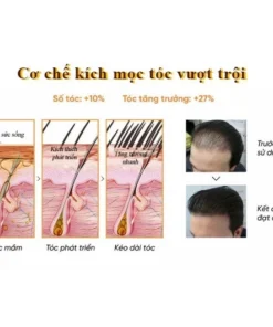 Serum mọc tóc DHT công nghệ Mỹ - Serum DHT kích tóc mọc tóc đen dày, bóng khỏe, giảm gãy rụng 30ml 13 moctoc5