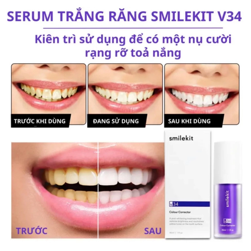 Serum làm trắng răng SmileKit V34, tinh chất làm trắng răng smilekit v34 - 30ml 25 trang4