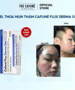Gel Giảm Mụn Cafuné Flux Derma gel chấm mụn kem dưỡng trắng da Mờ Thâm sẹo Cafuné Essence 20g 16 gelgiam8