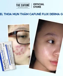 Gel Giảm Mụn Cafuné Flux Derma gel chấm mụn kem dưỡng trắng da Mờ Thâm sẹo Cafuné Essence 20g 17 gelgiam9