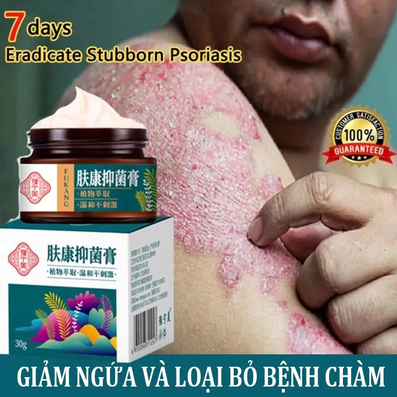 kem bôi nấm ngứa kem bôi ngoài da ghẻ ngứa Kem chống ngứa 30g kem bôi chàm Kem bôi vảy nến 1 kem bôi nấm ngứa kem bôi ngoài da ghẻ ngứa Kem chống ngứa 30g kem bôi chàm Kem bôi vảy nến