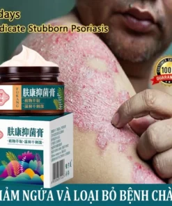 kem bôi nấm ngứa kem bôi ngoài da ghẻ ngứa Kem chống ngứa 30g kem bôi chàm Kem bôi vảy nến 12 kemnam2