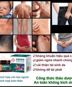 kem bôi nấm ngứa kem bôi ngoài da ghẻ ngứa Kem chống ngứa 30g kem bôi chàm Kem bôi vảy nến 13 kemnam3