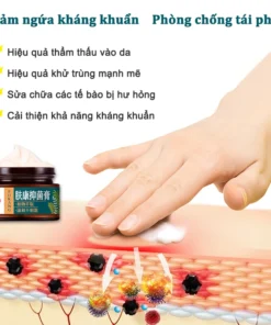 kem bôi nấm ngứa kem bôi ngoài da ghẻ ngứa Kem chống ngứa 30g kem bôi chàm Kem bôi vảy nến 17 kemnam7