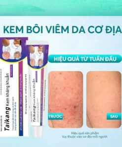 Kem bôi ngứa ngoài da Hỗ trợ dứt điểm Hắc lào,Ghẻ nước,Nấm da đầu,Vảy nến cực kì Hiệu quả Viêm da Giảm ngứa do muỗi đốt 13 kemngua6