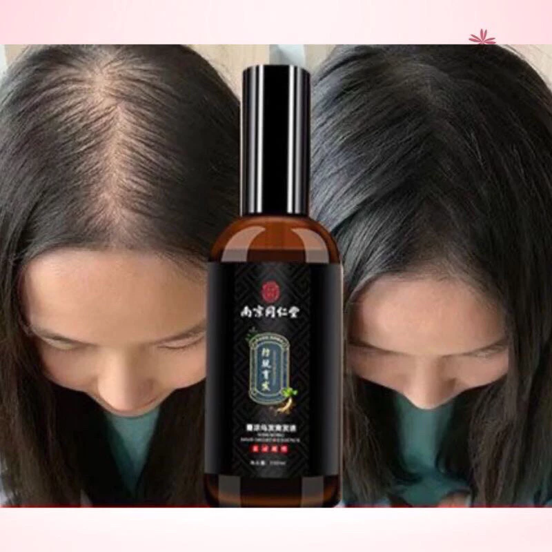 Chai Xịt Kích Thích Mọc Tóc Sâm Gừng Đồng Nhân Đường - Tinh Chất Xịt Sâm Gừng Nam Kinh TONGRENTANG Giảm Rụng Tóc 21 moctoc5