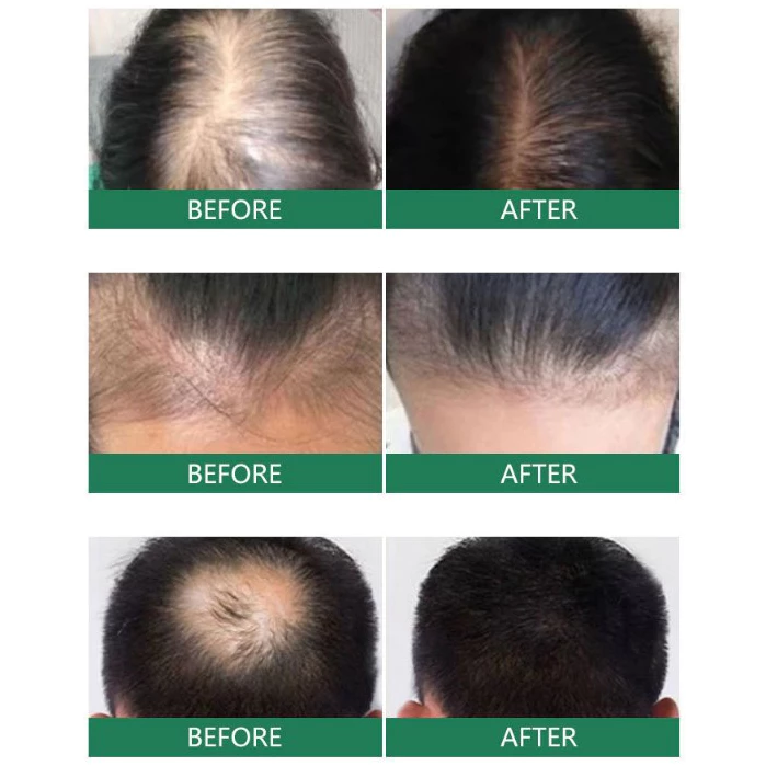 Chai Xịt Kích Thích Mọc Tóc Sâm Gừng Đồng Nhân Đường - Tinh Chất Xịt Sâm Gừng Nam Kinh TONGRENTANG Giảm Rụng Tóc 19 moctoc7