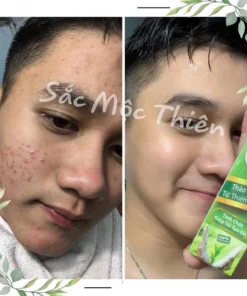 Alternative view of Tinh Chất Giúp Tái Tạo Cao Cấp Sắc Mộc Thiên 30ml