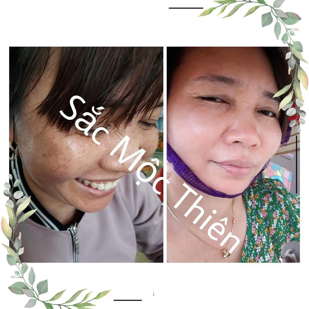 Tinh Chất Giúp Tái Tạo Cao Cấp Sắc Mộc Thiên 30ml 19 sacmoc4