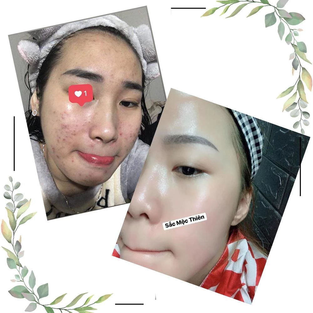 Tinh Chất Giúp Tái Tạo Cao Cấp Sắc Mộc Thiên 30ml 17 sacmoc7