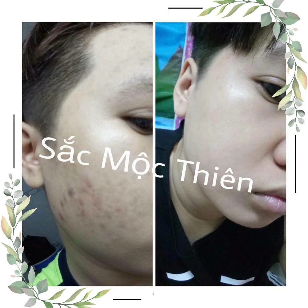 Tinh Chất Giúp Tái Tạo Cao Cấp Sắc Mộc Thiên 30ml 16 scmoc5
