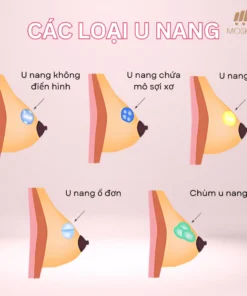 Kem Bôi Massage Tan U Bứu Tuyến Vú Senjoko Nhật Bản 50g, Giúp Tan U Tuyến Vú, Giảm Đau Nhức Vón Cục Cứng, Tiêu U Vú 14 senko6