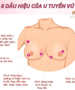 Kem Bôi Massage Tan U Bứu Tuyến Vú Senjoko Nhật Bản 50g, Giúp Tan U Tuyến Vú, Giảm Đau Nhức Vón Cục Cứng, Tiêu U Vú 18 sensoko5