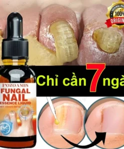 Serum Trị Nấm Móng Tay Chân Hết Sạch Nấm,Móng quặp nặng, Bọng Móng, móng tay móng chân bị cuốn 19 mong1
