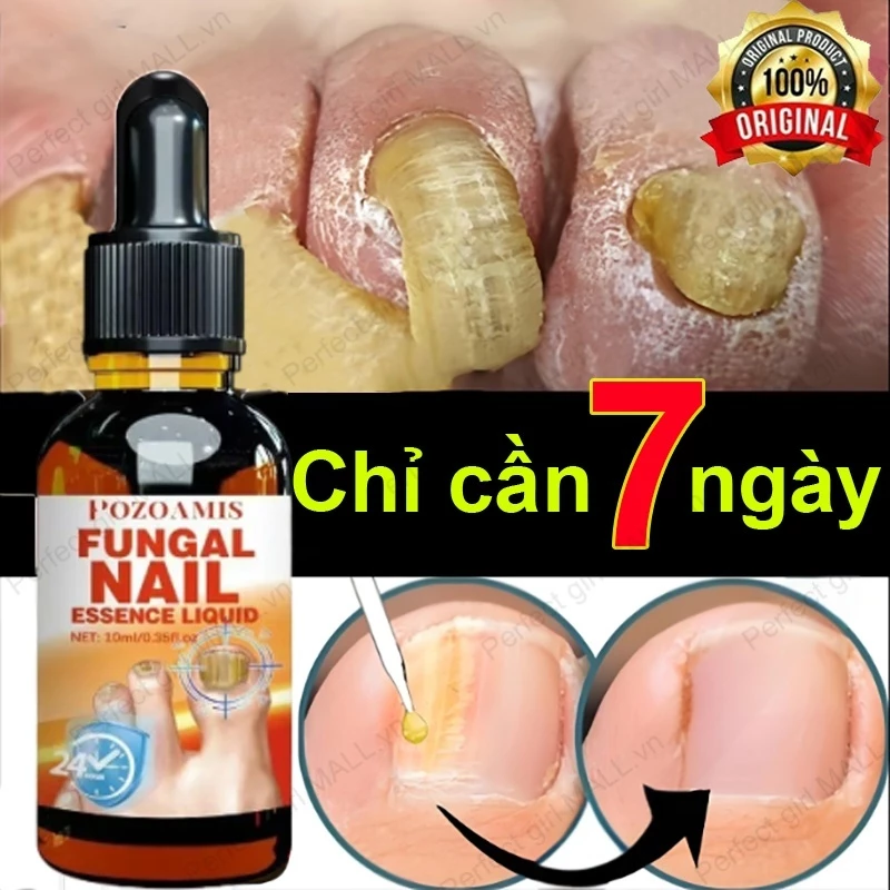 Serum Trị Nấm Móng Tay Chân Hết Sạch Nấm,Móng quặp nặng, Bọng Móng, móng tay móng chân bị cuốn 36 mong1
