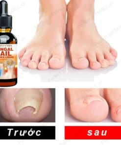 Serum Trị Nấm Móng Tay Chân Hết Sạch Nấm,Móng quặp nặng, Bọng Móng, móng tay móng chân bị cuốn 20 mong2