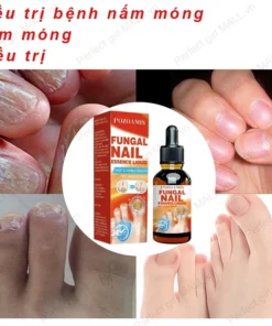 Serum Trị Nấm Móng Tay Chân Hết Sạch Nấm,Móng quặp nặng, Bọng Móng, móng tay móng chân bị cuốn 24 mong6