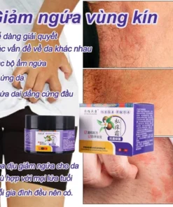Kem giảm ngứa Kem bôi nấm ngứa Chăm sóc vùng kín Chống ngứa nhanh 30g Giảm nhẹ ngứa da Bên trong đùi Hậu môn Chàm Mông