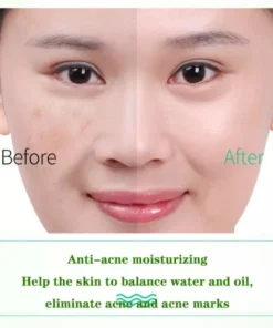 Gel Nha Đam Dưỡng Ẩm & Làm Mềm Da - Gel Lô Hội 92% Aloe Vera Gel 13 nhadam4