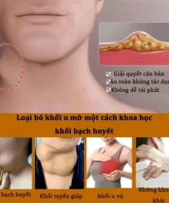 Kem tan u mỡ Kem tan mỡ Kem lipoma 20g Kem tan mỡ chính hãng cho nhiều cục u dưới da đơn lẻ u tuyến 12 anmo5