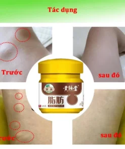 Kem tan u mỡ Kem tan mỡ Kem lipoma 20g Kem tan mỡ chính hãng cho nhiều cục u dưới da đơn lẻ u tuyến 13 anmo7