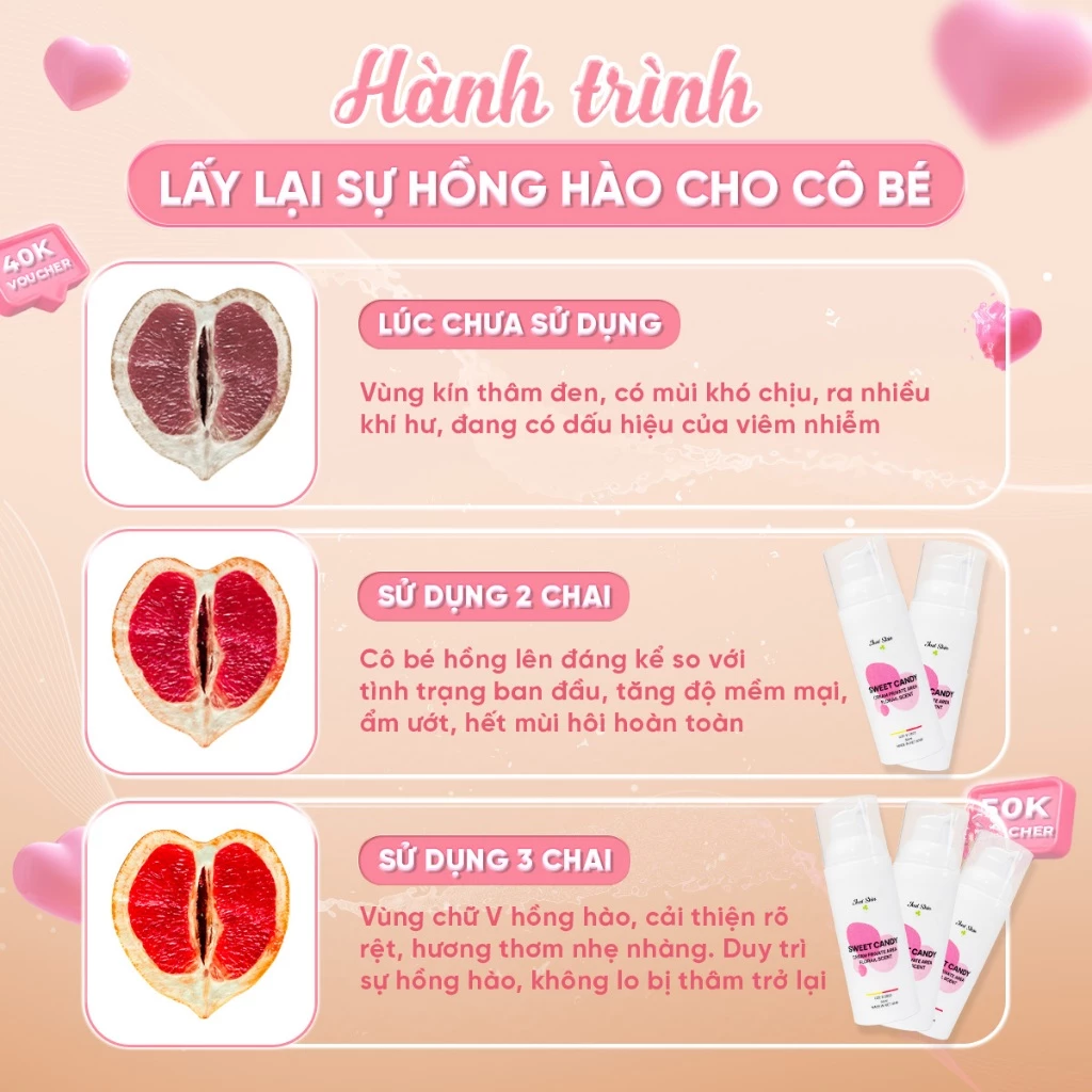 Kem Hồng Nhũ Hoa Sweet Candy Just Skin Làm Hồng Vùng Kín, Trẻ Hoá Giảm Thâm Bikini Hương Thơm Mát 17 nhuhoa3 1