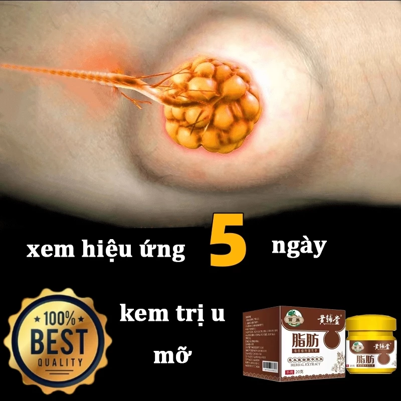 Kem tan u mỡ Kem tan mỡ Kem lipoma 20g Kem tan mỡ chính hãng cho nhiều cục u dưới da đơn lẻ u tuyến 8 Kem tan u mỡ Kem tan mỡ Kem lipoma 20g Kem tan mỡ chính hãng cho nhiều cục u dưới da đơn lẻ u tuyến - Ảnh 8