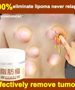 Alternative view of ⭐CHÍNH HÃNG⭐Kem tan u mỡ Tan u cứng U mỡ Kem u tuyến giáp 30g Kem tan mỡ chính hãng cho