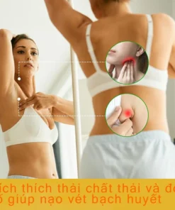 kem tan hạch bạch huyết Giảm viêm bạch huyết giảm cục u dưới da mỡ tiêu tan hạch bạch huyết Giảm Sưng Tấy và mứt 17 bachuye6