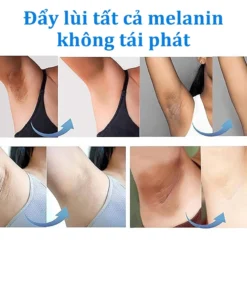 Kem Dưỡng Trắng Da Mờ Thâm Nách, Mông, Đầu Gối, Khuỷu Tay Vitamin C Whitening SADOER 50ml Mờ Đốm Thâm Dưỡng Ẩm EELHOE 11 hamnach