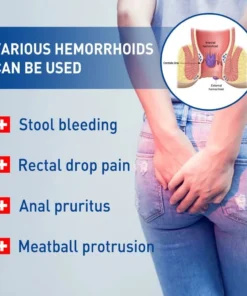 100% Nhật Bản chính gốc kem bôi trĩ 20g làm giảm sưng trĩ và đau ra máu trong điều phân điều bên trong trĩ bên