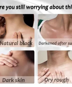 Alternative view of Kem làm trắng da thân mật, nách, đầu gối, đùi Serum phát sáng, loại bỏ Melanin - Kem làm trắng cơ thể thân mật, Nách, Đầu gối, Serum