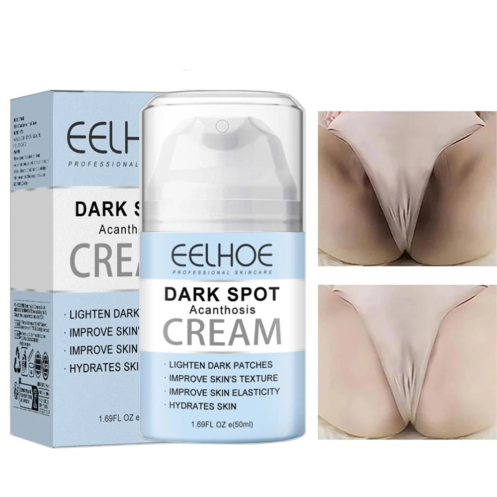 Kem Dưỡng Trắng Da Mờ Thâm Nách, Mông, Đầu Gối, Khuỷu Tay Vitamin C Whitening SADOER 50ml Mờ Đốm Thâm Dưỡng Ẩm EELHOE 29 thamnach