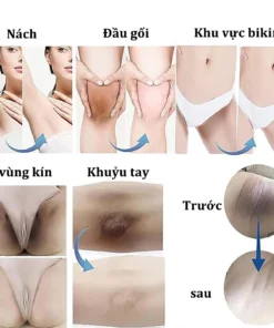 Kem Dưỡng Trắng Da Mờ Thâm Nách, Mông, Đầu Gối, Khuỷu Tay Vitamin C Whitening SADOER 50ml Mờ Đốm Thâm Dưỡng Ẩm EELHOE 19 thmnach2