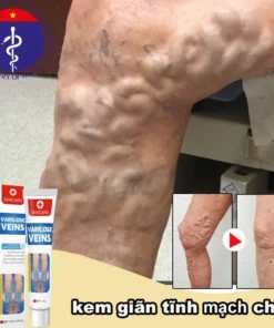Kem Giãn Tĩnh Mạch Nga Cải Thiện Lưu Thông Máu Giữ Lại Vẻ Đẹp Cho Đôi Chân 13 cogian1 1