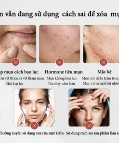 Alternative view of Kem chấm mụn Gel giảm mụn 25g giảm thâm ngăn mụn tái phát kem bôi mụn làm mờ thâm mụn Giảm Sưng Đỏ chăm sóc da mặt