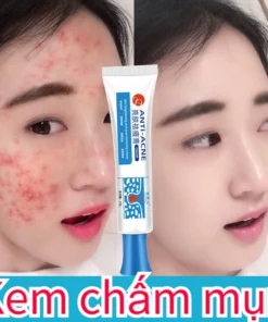 Kem chấm mụn Gel giảm mụn 25g giảm thâm ngăn mụn tái phát kem bôi mụn làm mờ thâm mụn Giảm Sưng Đỏ chăm sóc da mặt