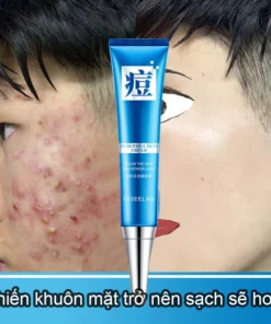 Kem tẩy mụn kem loại bỏ mụn trứng cá [Loại bỏ mụn trong 3 ngày] kem loại bỏ mụn nhanh,làm mờ vết mụn một cách hiệu quả
