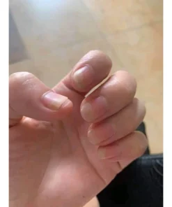 Alternative view of Serum đánh bay nấm móng, hư khoé, bọng móng, nước ăn tay chân gia truyền