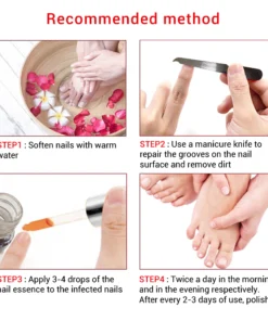 Alternative view of Tinh Chất Sửa Chữa Móng Tay Serum Nấm Điều Trị Móng Tay Loại Bỏ Onychomycosis Móng Tay Nấm Ngón Chân Chăm Sóc Da Chân