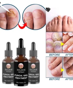 Alternative view of Tinh chất phục hồi móng EELHOE ANNIES 30ml/ 50ml loại bỏ nấm chăm sóc móng tay móng chân