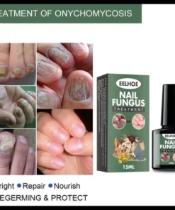 Alternative view of Serum Trị Nấm Móng Tay Chân ELLHOE Hết Sạch Nấm, Bọng Móng, Hư Khoé Nước Ăn Tay Chân Dưỡng Cứng Móng