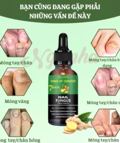 TINH CHẤT LOẠI BỎ NẤM MÓNG GINGER EELHOE 7 NGÀY - NẤM MÓNG LÂU NĂM CŨNG HẾT, CAM KẾT KHÔNG TÁI LẠI 10 nammong4 2