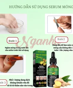 TINH CHẤT LOẠI BỎ NẤM MÓNG GINGER EELHOE 7 NGÀY - NẤM MÓNG LÂU NĂM CŨNG HẾT, CAM KẾT KHÔNG TÁI LẠI 13 namong6 4