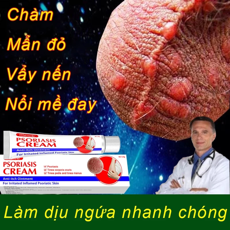kem bôi nấm ngứa nhật bản bôi nấm ngứa vùng kín nam chống dị ứng khỏi tận gốc viêm da bệnh chàm Ngứa da nấm da nấm mụn n 1 kem bôi nấm ngứa nhật bản bôi nấm ngứa vùng kín nam chống dị ứng khỏi tận gốc viêm da bệnh chàm Ngứa da nấm da nấm mụn n